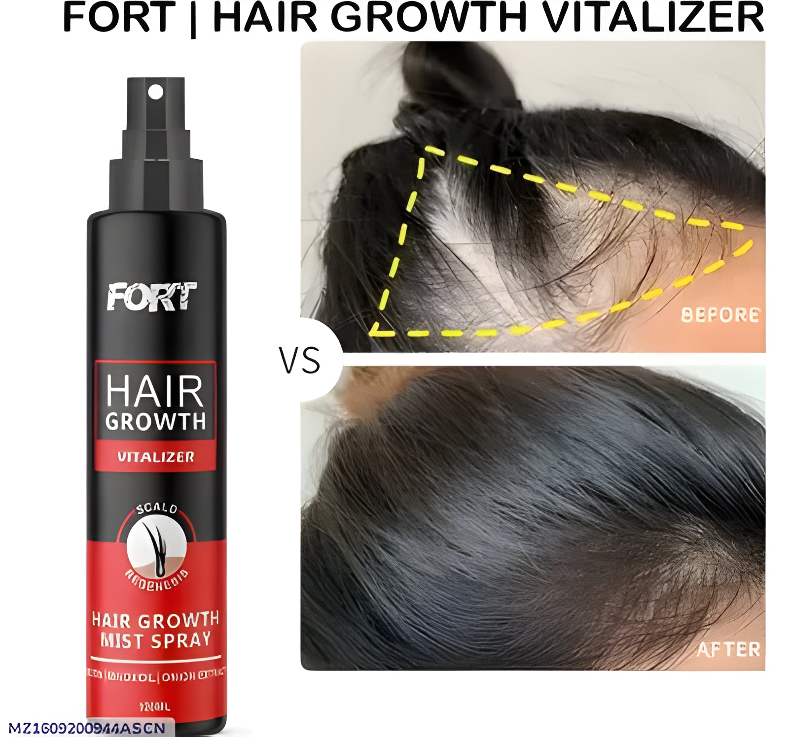Fort Hair Growth Vitalizer 120ML Anti-Dandruff Fall Prevention
