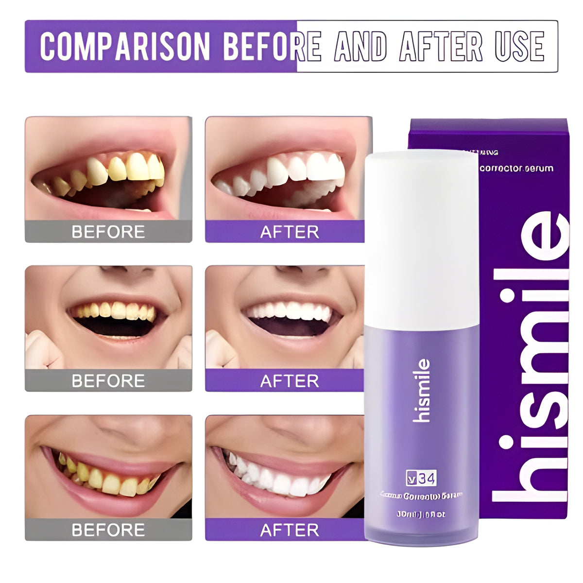 Hismile V34 Color Corrector Serum | High Quality | Instant Teeth Brightening Solution | 30ml